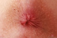 ATK hairy  in young and hairy