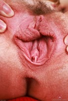 ATK hairy  in young and hairy