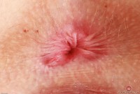 ATK hairy Kallie Taylor Set