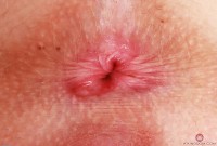 ATK hairy Kallie Taylor Set