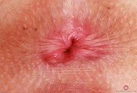 ATK hairy Kallie Taylor Set