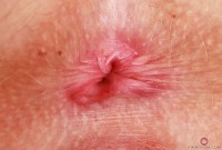 ATK hairy Kallie Taylor Set