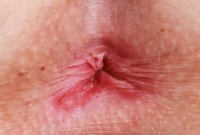 ATK hairy Kallie Taylor Set