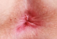 ATK hairy Kallie Taylor Set