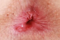 ATK hairy Kallie Taylor Set
