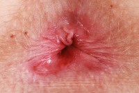 ATK hairy Kallie Taylor Set