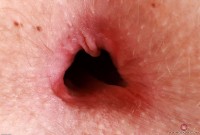 ATK hairy Kallie Taylor Set