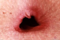 ATK hairy Kallie Taylor Set