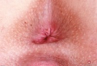 ATK hairy Kallie Taylor Set