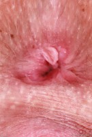 ATK hairy Kallie Taylor Set