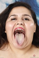 ATK hairy  in mature and hairy