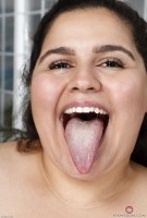 ATK hairy  in mature and hairy