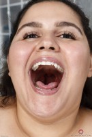 ATK hairy  in mature and hairy