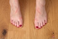 ATK hairy  in young and hairy