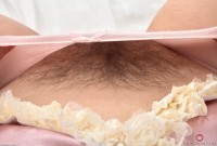 ATK hairy  in young and hairy