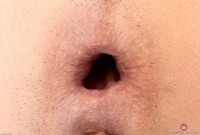 ATK hairy  in young and hairy