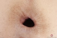 ATK hairy  in young and hairy