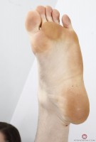 ATK hairy  in young and hairy