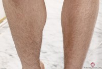 ATK hairy  in young and hairy