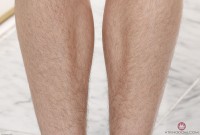 ATK hairy  in young and hairy