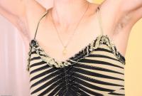 ATK hairy  in mature and hairy