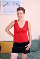 ATK hairy  in mature and hairy