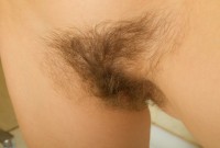 ATK hairy  in young and hairy