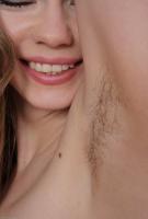 ATK hairy  in young and hairy