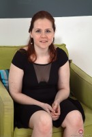 ATK hairy  in young and hairy