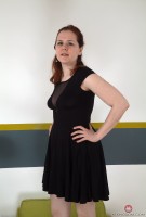 ATK hairy  in young and hairy