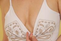 ATK hairy  in mature and hairy