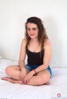 ATK hairy  in mature and hairy