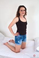 ATK hairy  in mature and hairy