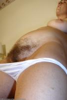 ATK hairy  in mature and hairy