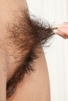 ATK hairy  in mature and hairy