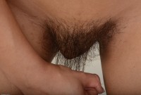 ATK hairy  in mature and hairy