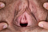 ATK hairy  in mature and hairy