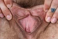 ATK hairy  in mature and hairy