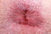 ATK hairy Kitty Strange Set