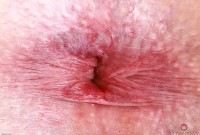 ATK hairy Kitty Strange Set