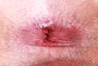 ATK hairy Kitty Strange Set