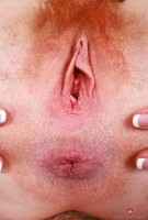 ATK hairy  in young and hairy