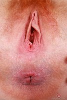 ATK hairy  in young and hairy