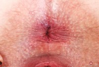 ATK hairy  in young and hairy