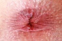 ATK hairy Kitty Strange in young and hairy