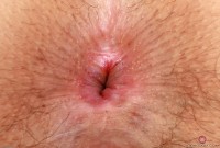 ATK hairy  in exotic and hairy