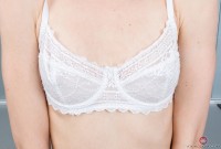 ATK hairy  in mature and hairy