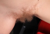 ATK hairy  in young and hairy
