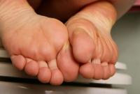 ATK hairy  in young and hairy