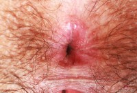 ATK hairy Kyra Rose Set